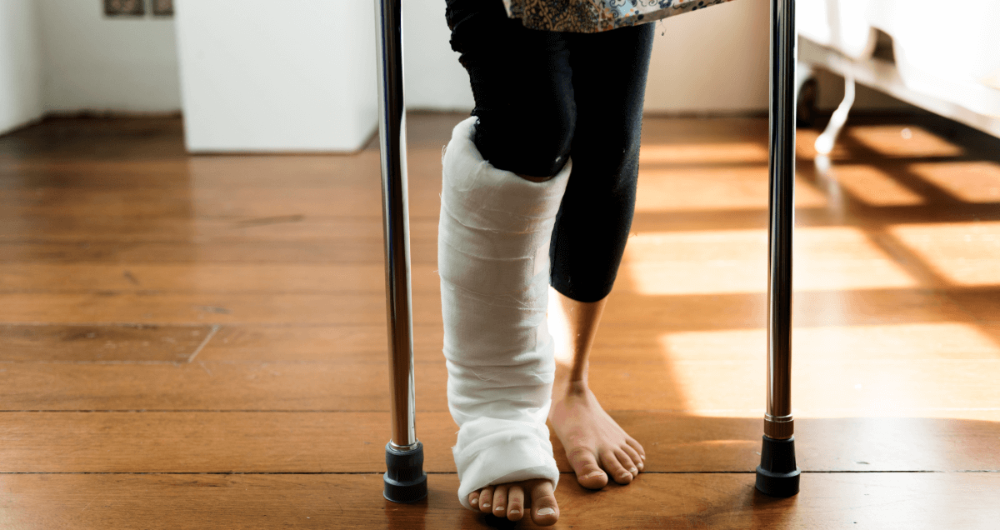 orthopédie jambe cassée