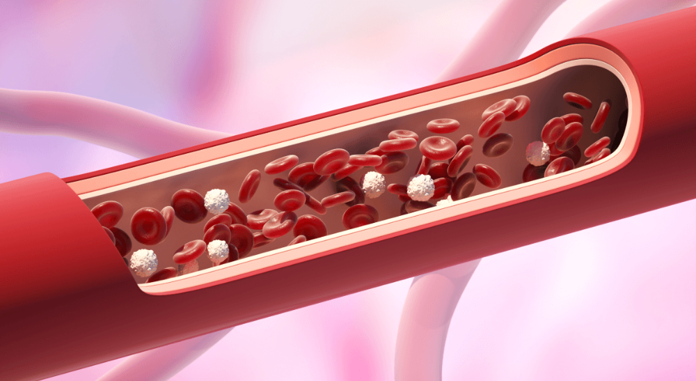 L’angiographie : un examen pour analyser les vaisseaux sanguins