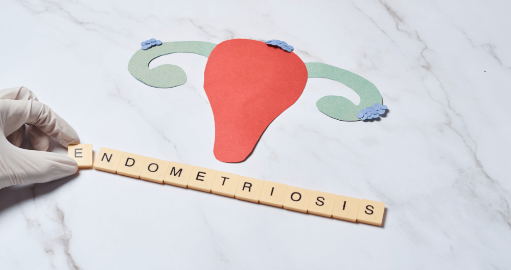 L'endométriose : quelles sont les causes de cette maladie ?