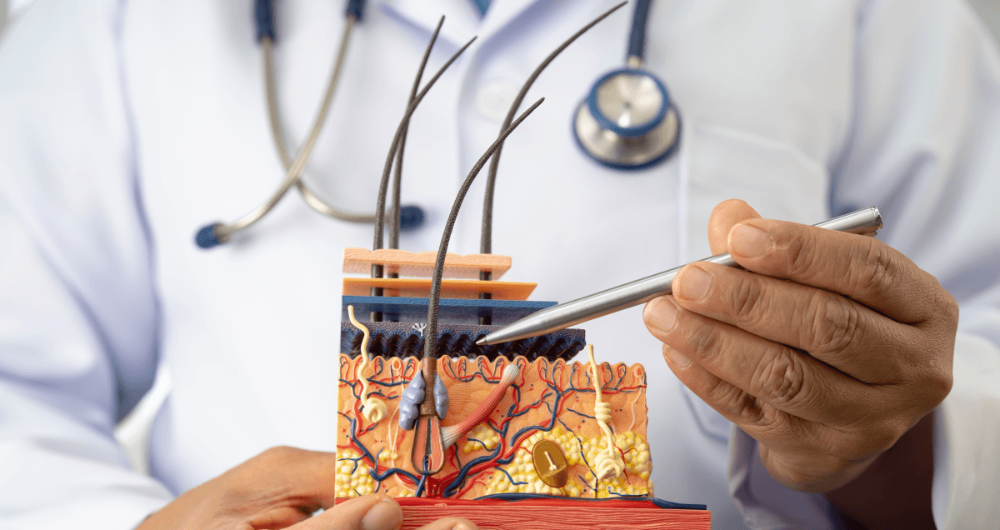 Cancer de la peau : les causes
