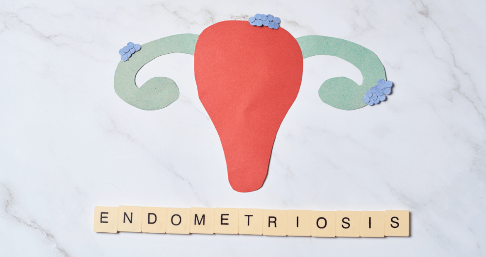 Qu'est-ce que l'endométriose ?